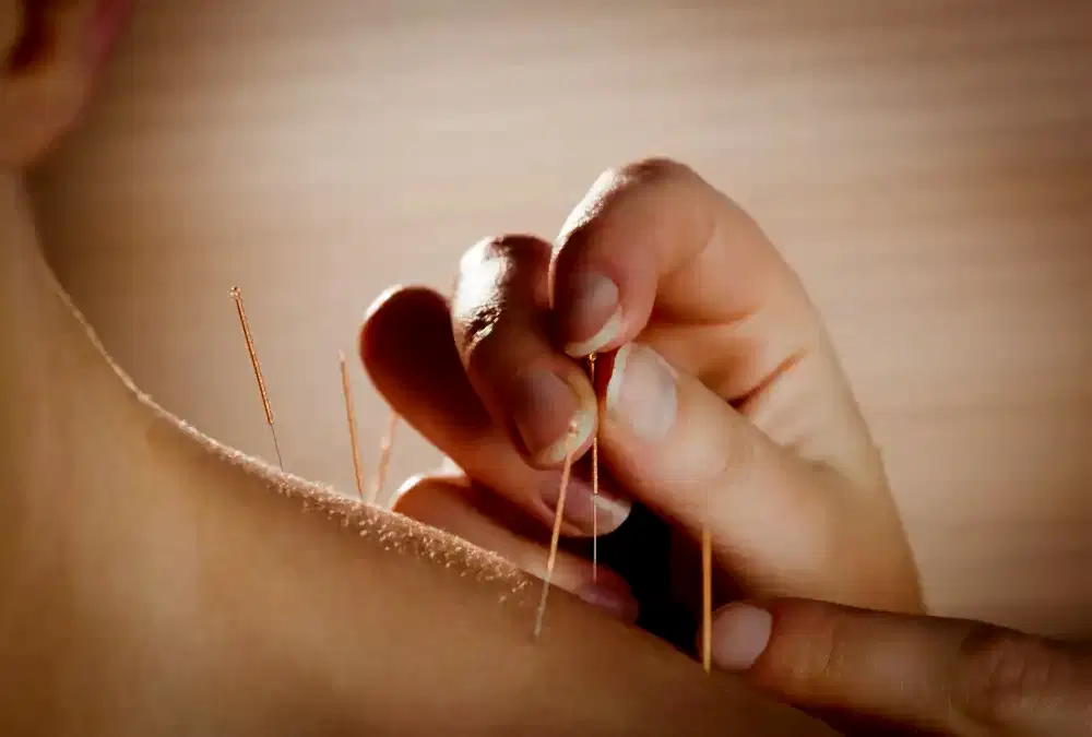 Altın İğne Uygulaması