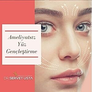 Ankara Alın Botoksu