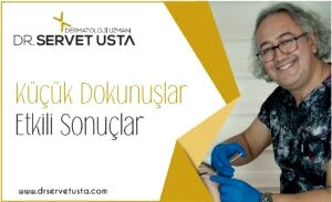 Aşırı Terleme için Botoks Uygulaması