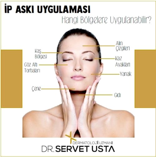 Ameliyatsız Yüz Germe Ankara