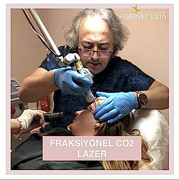 İnce ve Derin Kırışıklık Tedavisi Ankara