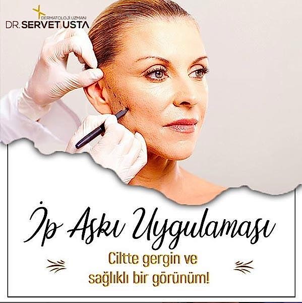 Ankara İp Askı Uygulaması ile Kaş Kaldırma