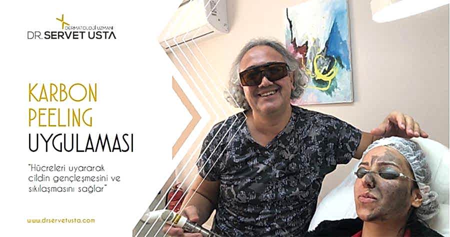 Karbon Peeling Ankara