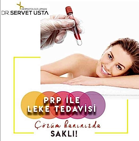 Ankara Leke Tedavisi