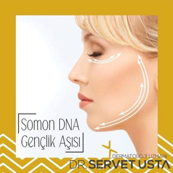 Somon DNA Ankara Uygulama