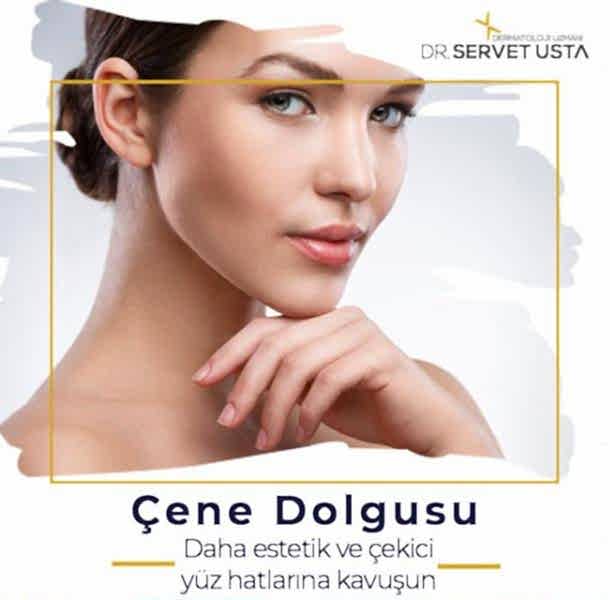 Çene Dolgusu Ankara