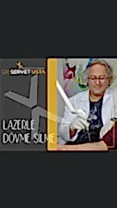 lazerle dövme silme