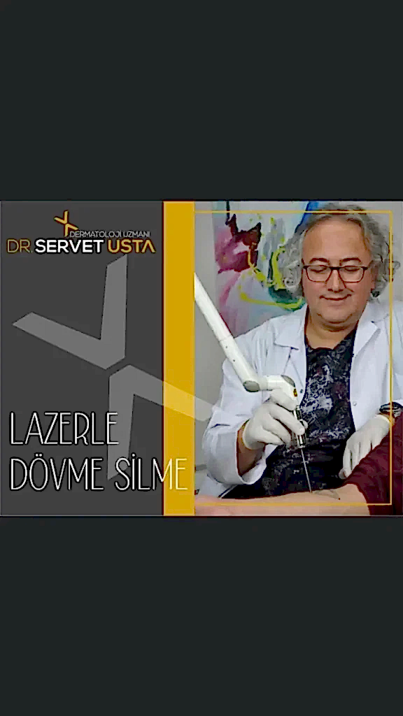 lazerle dövme silme