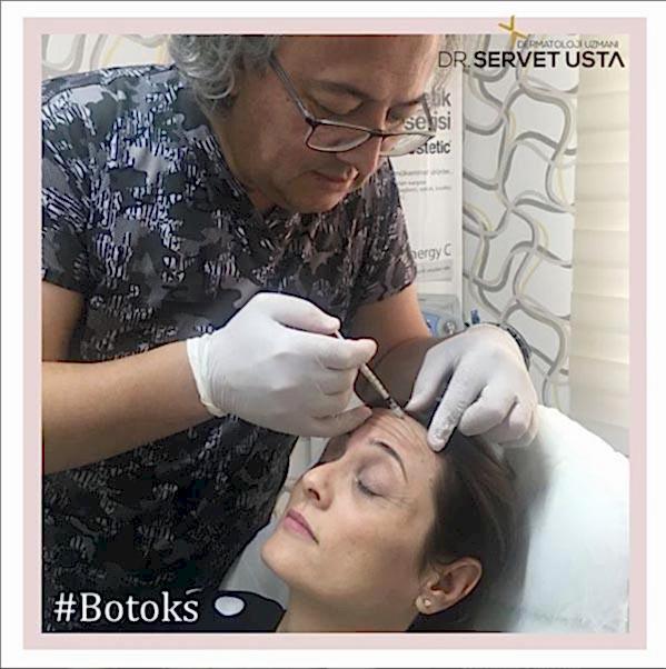 Ankara Botoks Uygulama
