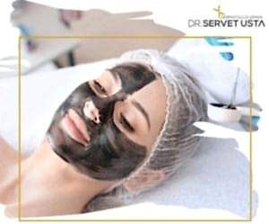 Ankara Kimyasal Peeling Uygulaması