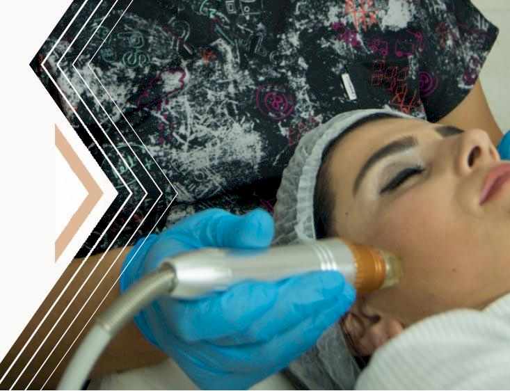 Ankara Mikro İğne Uygulaması